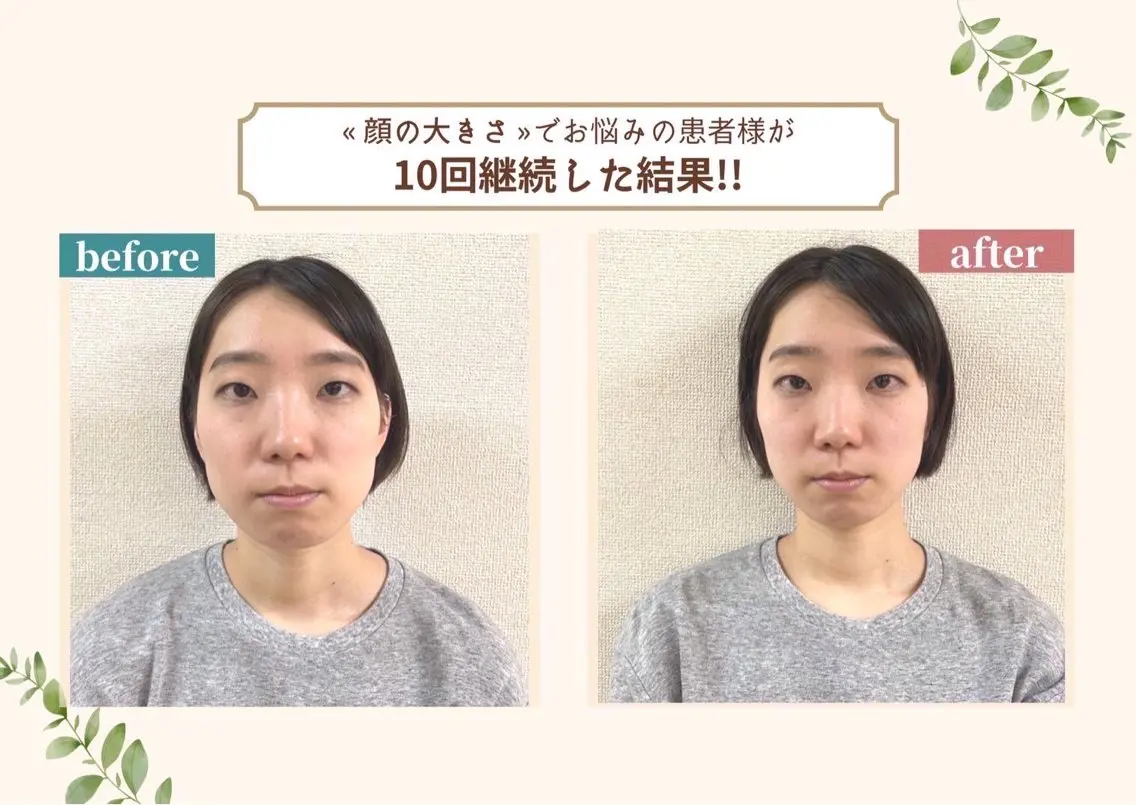 ［初回期間限定価格］小顔整体＋姿勢調整の写真