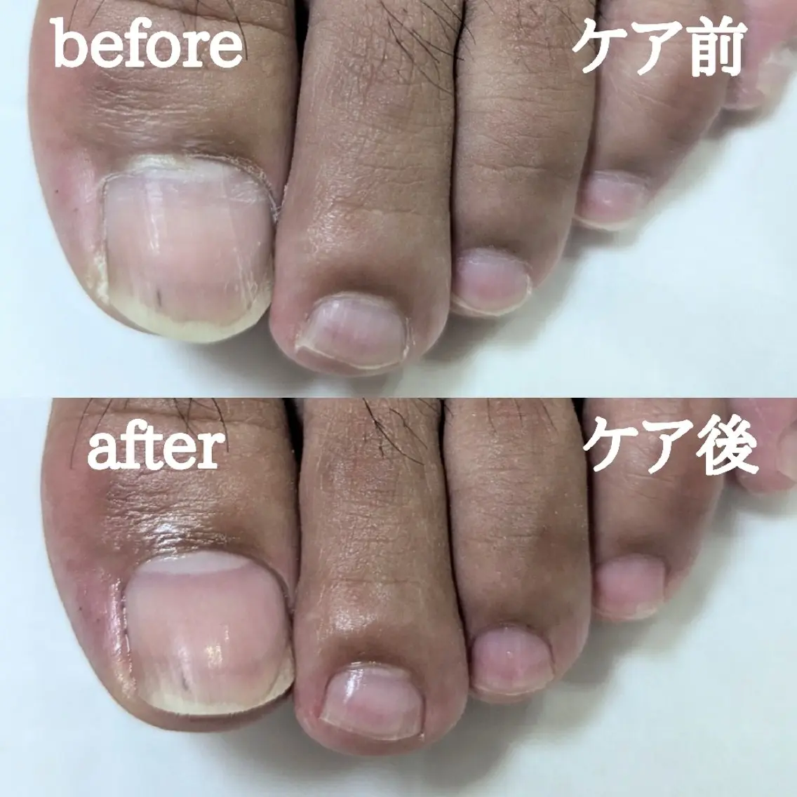 👣メンズOK💅フットネイルケアのみ🦶✨甘皮ケア&磨き✨の写真