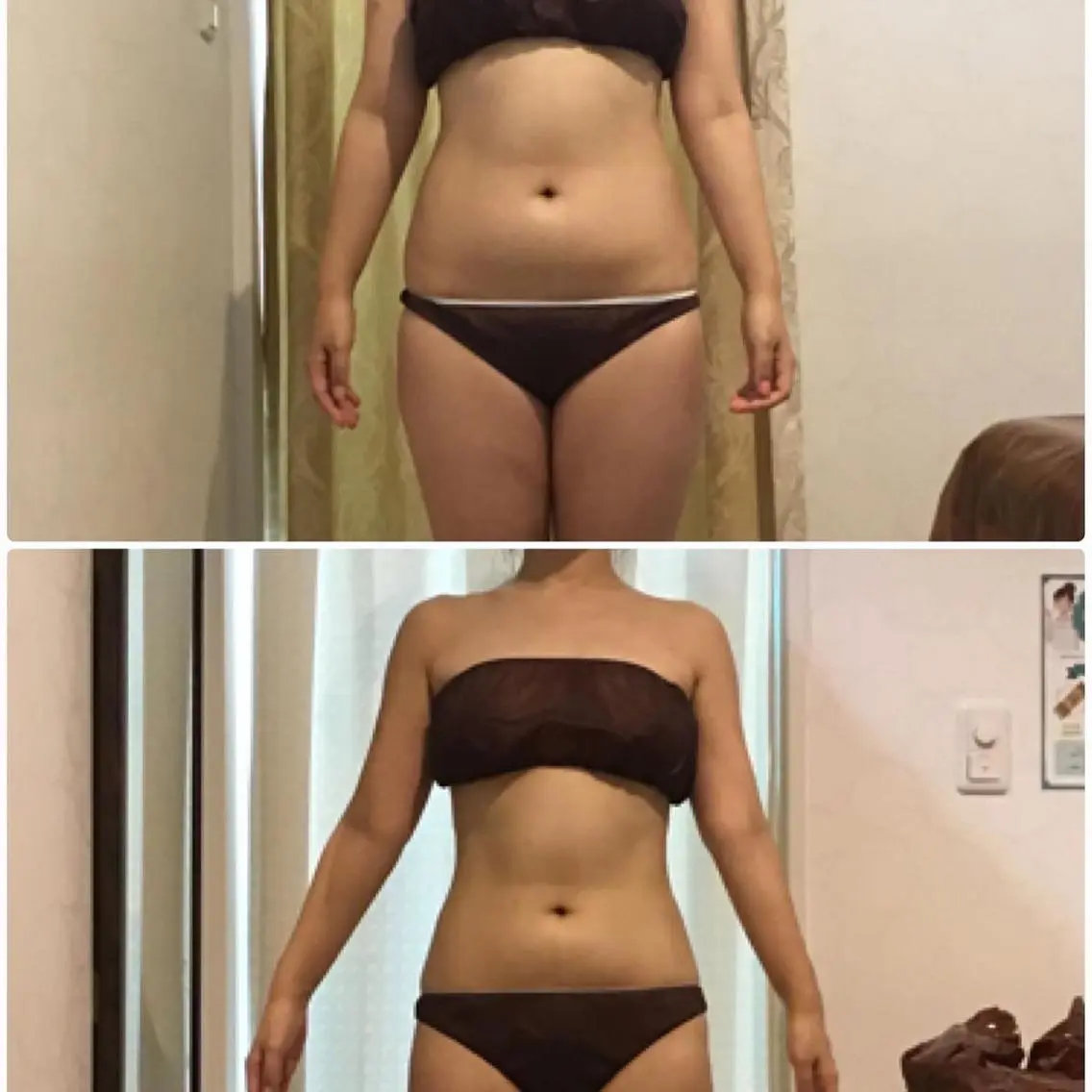 次世代ハイ フォーカスボディ+期間限定ラジオ波付き 美Bodyへの写真