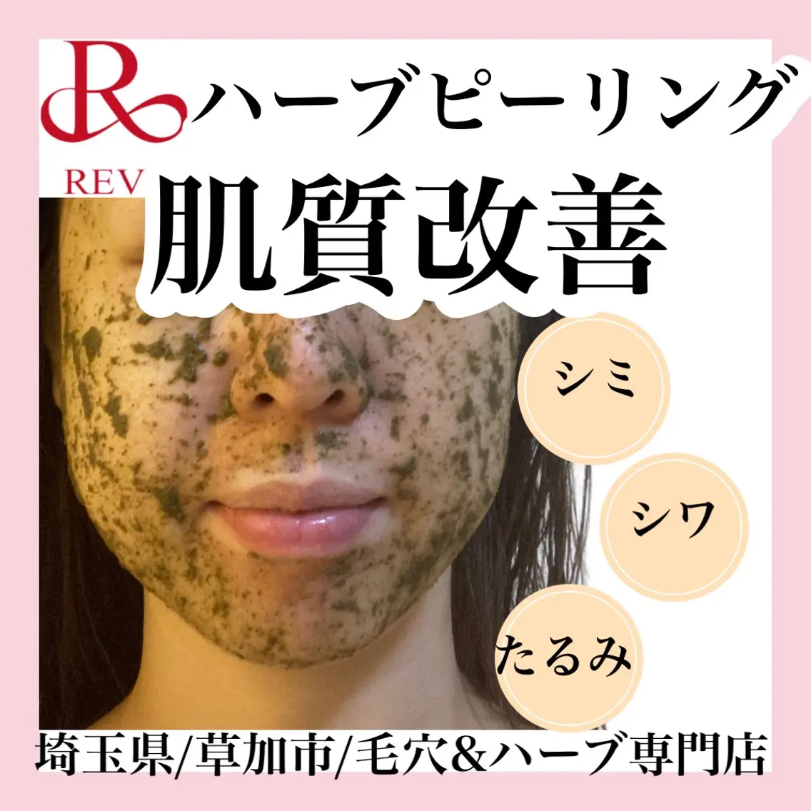 ハーブピーリング　スペシャルコース(ベッドマッサージ付)の写真