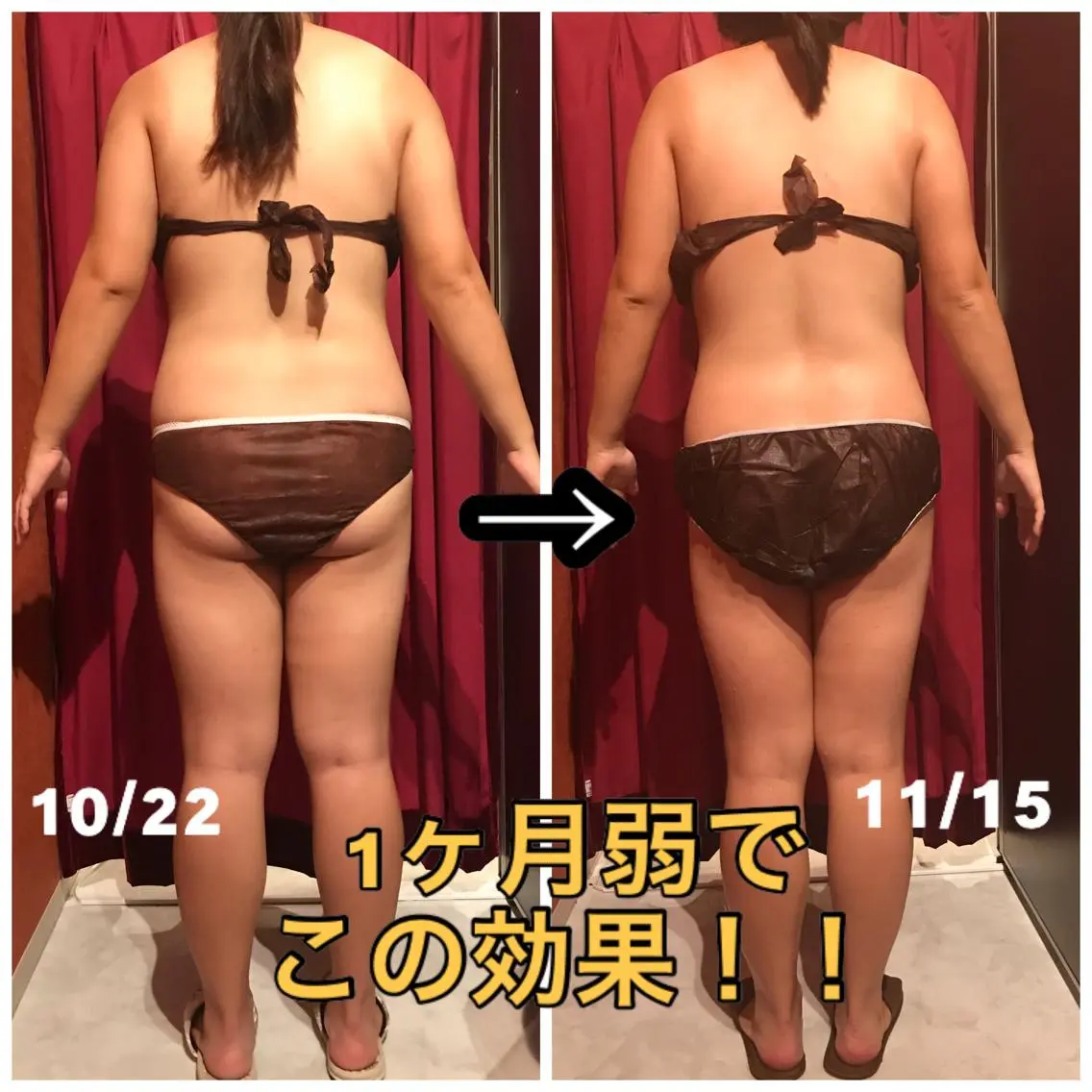 Cielo(シエロ) ダイエット専門店のエステ・リラクイメージ