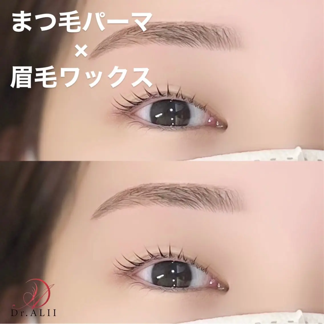 アイブロウ 眉毛ワックス脱毛 ワックス脱毛 その他(アイブロウ) Dr.ALII 岐南店 鈴村のエステ・リラクイメージ