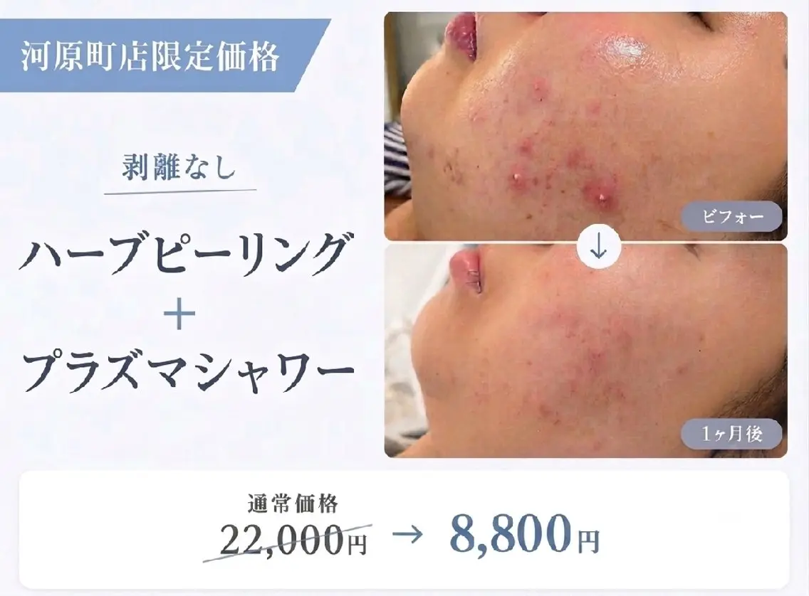 エステ 韓国肌管理Belle 河原町・四条・烏丸のエステ・リラクイメージ