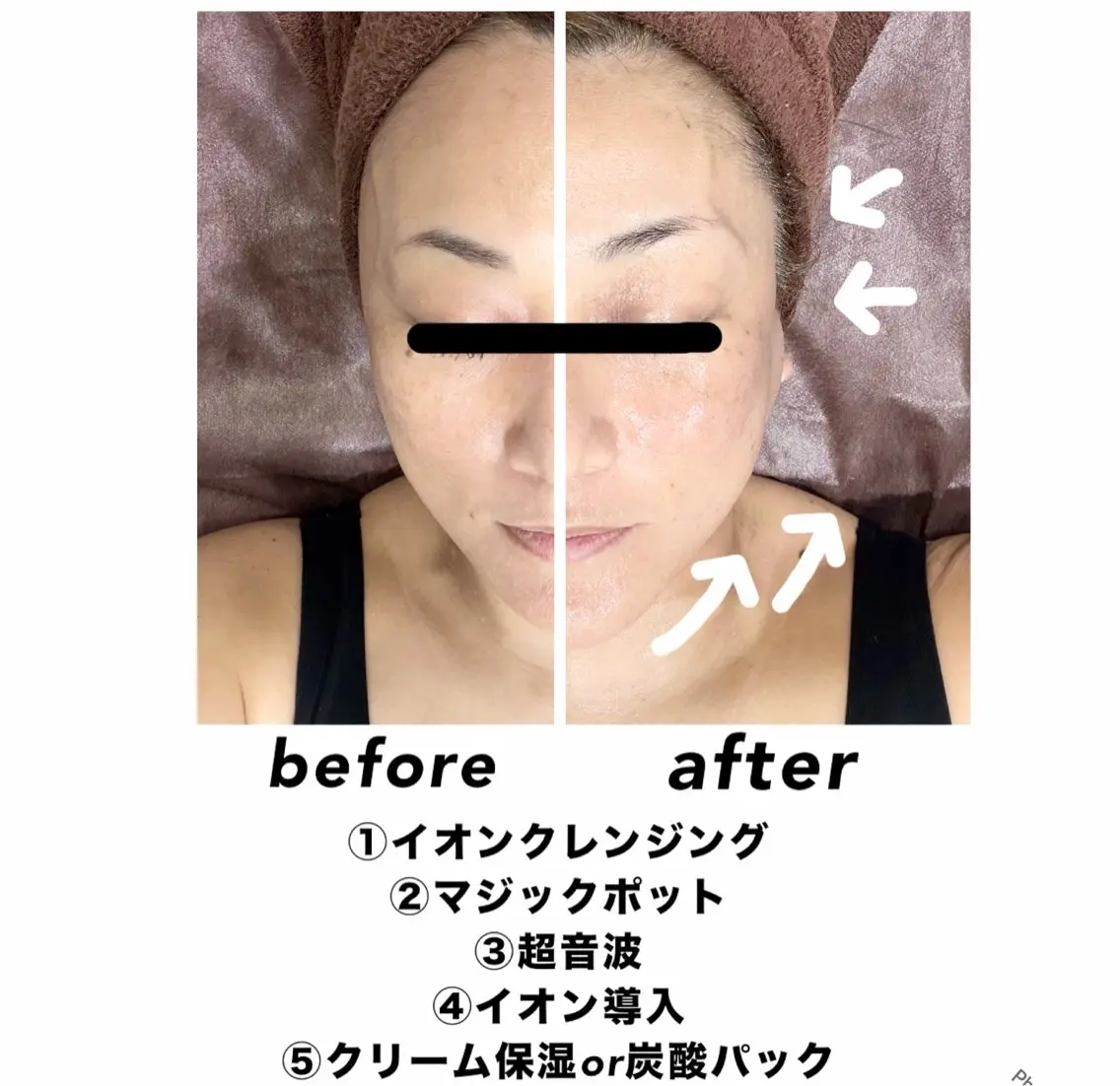 ネイル・エステサロン UILANIのエステ・リラクイメージ