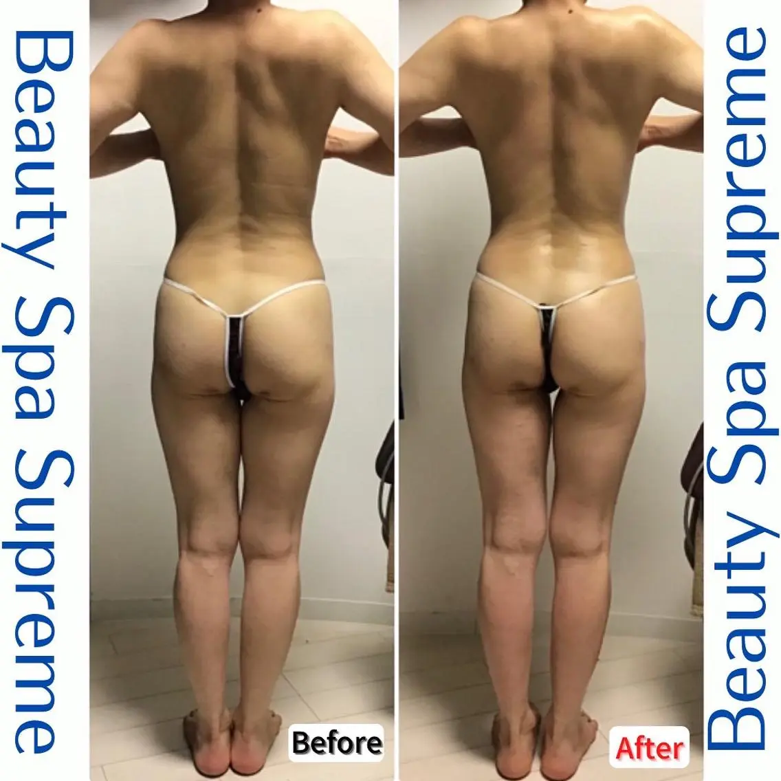 Beauty Spa Supreme小玉のエステ・リラクイメージ