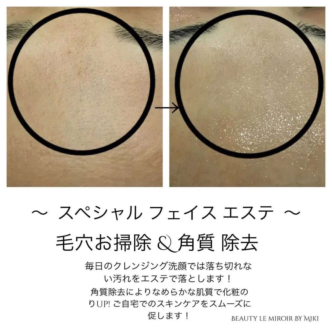 ビューティー ミロワールのエステ・リラクイメージ