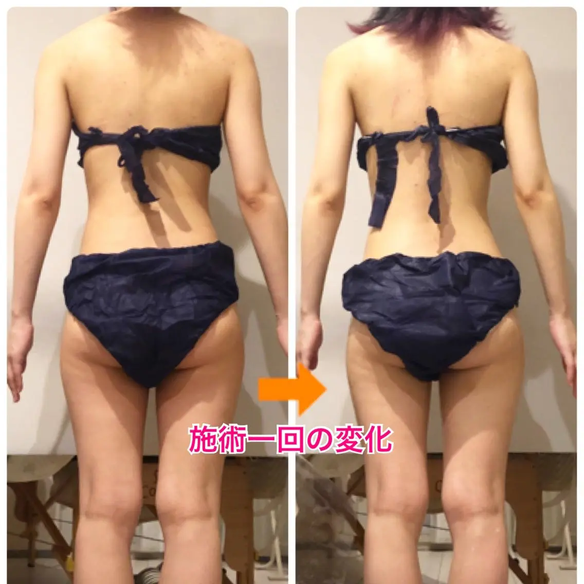 ロング カラー パーマ ヘアアレンジ メンズ キッズ ネイル マツエク・マツパ 痩身&ボディ 結果出し🌟丹野のエステ・リラクイメージ