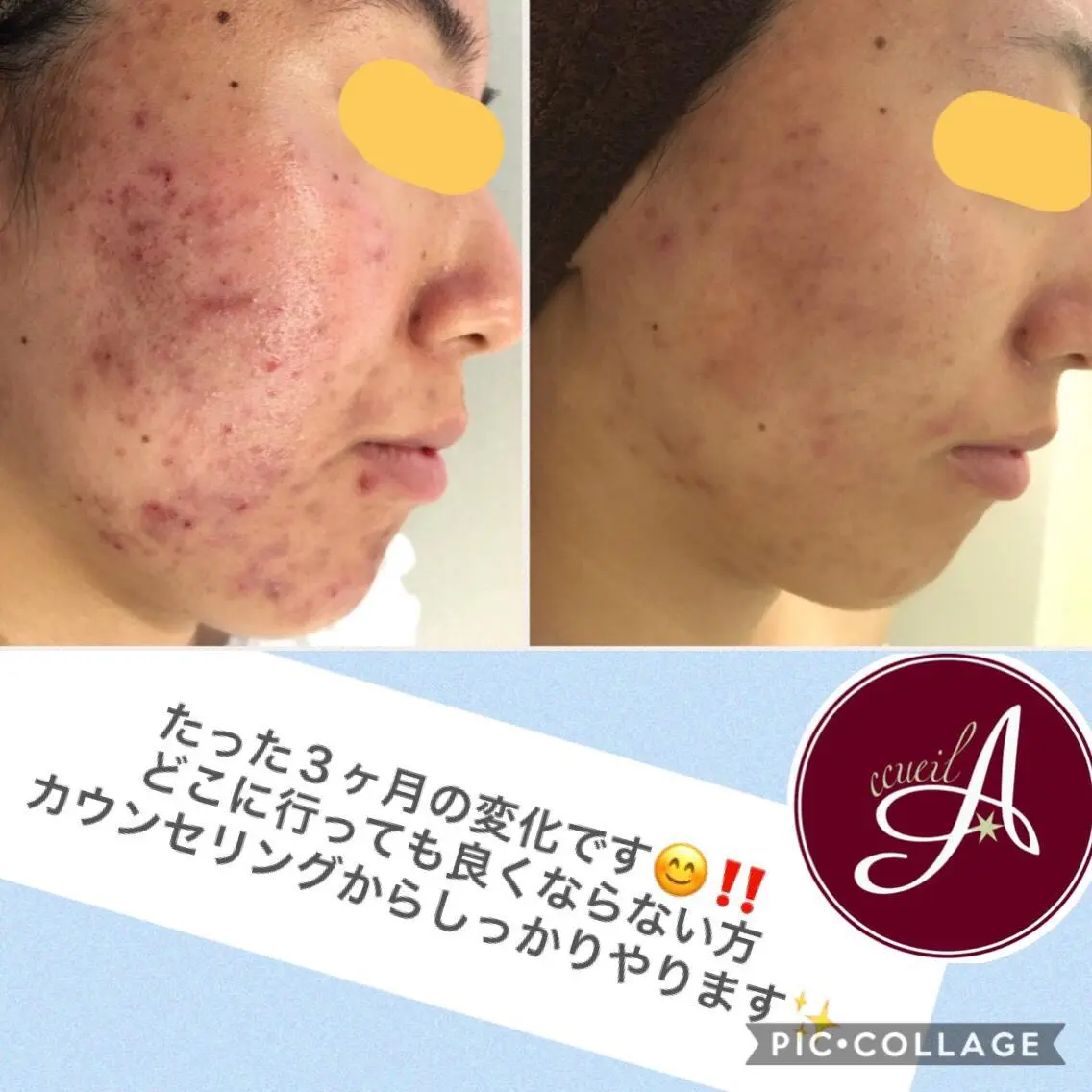 ミディアム カラー パーマ ヘアアレンジ メンズ キッズ ネイル マツエク・マツパ ニキビ・肌質改善専門 ♡人生が変わるサロンのエステ・リラクイメージ