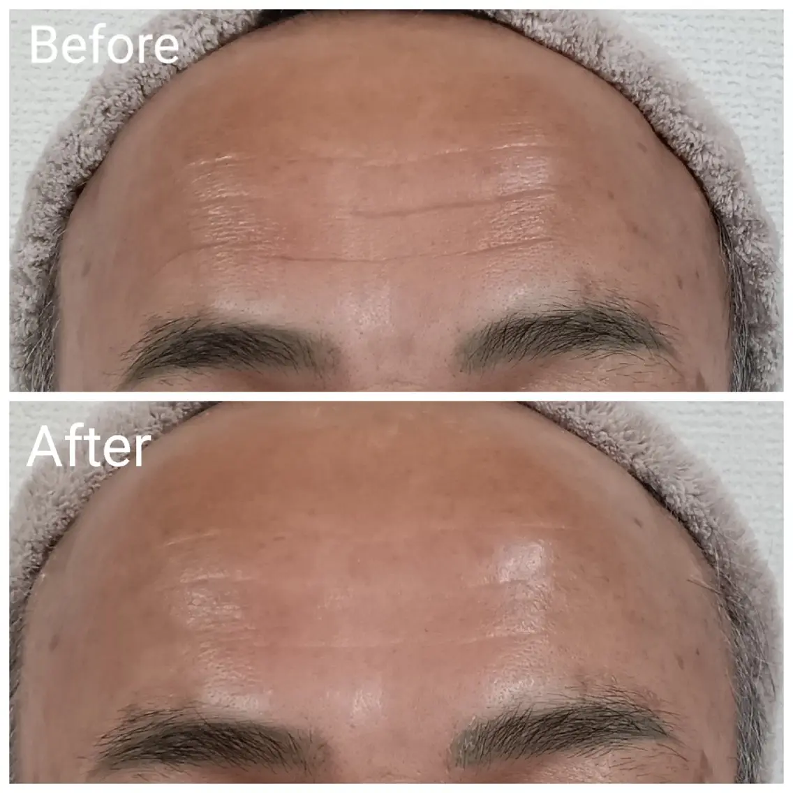 メンズ 肌質改善Beauty salon Renのエステ・リラクイメージ
