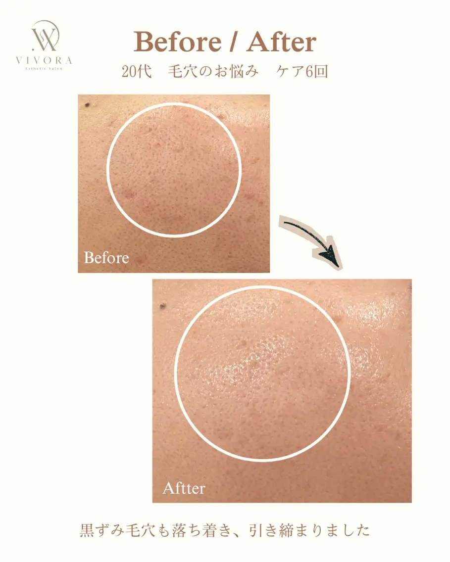 エステ VIVORA ASAMI🌿のエステ・リラクイメージ
