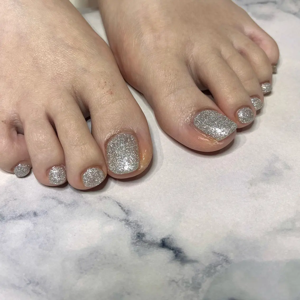 フットネイル・付け替えオフなし(ワンカラー)の写真