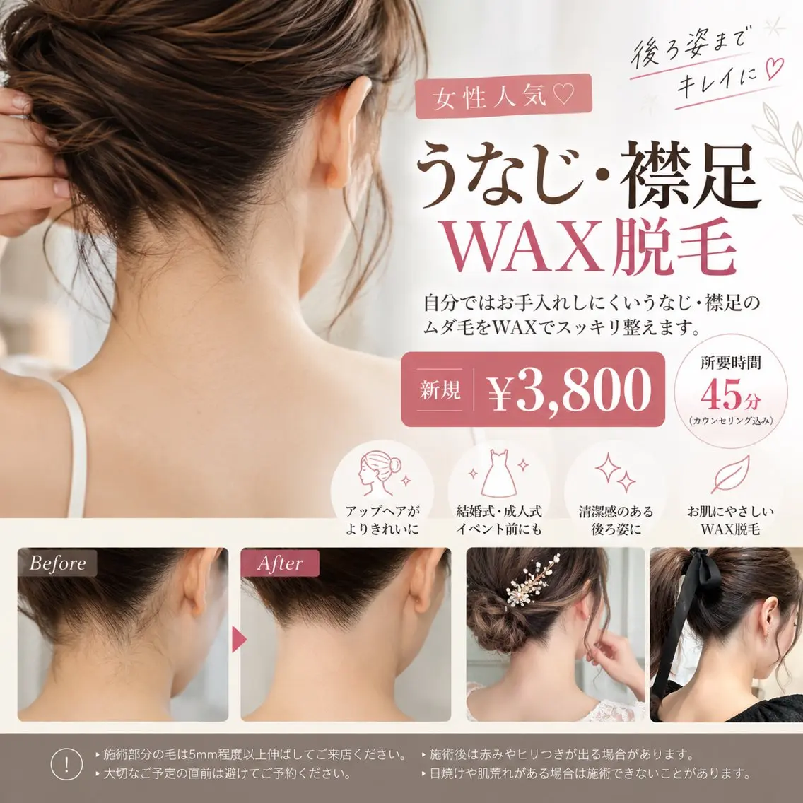 【女性人気♡】うなじ・襟足WAX脱毛✨後ろ姿美人にの写真