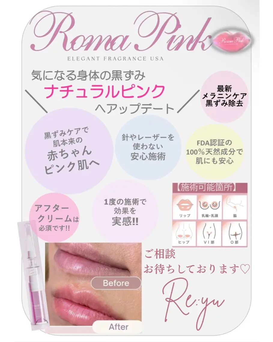 RomaPink(ローマピンク)相談の写真