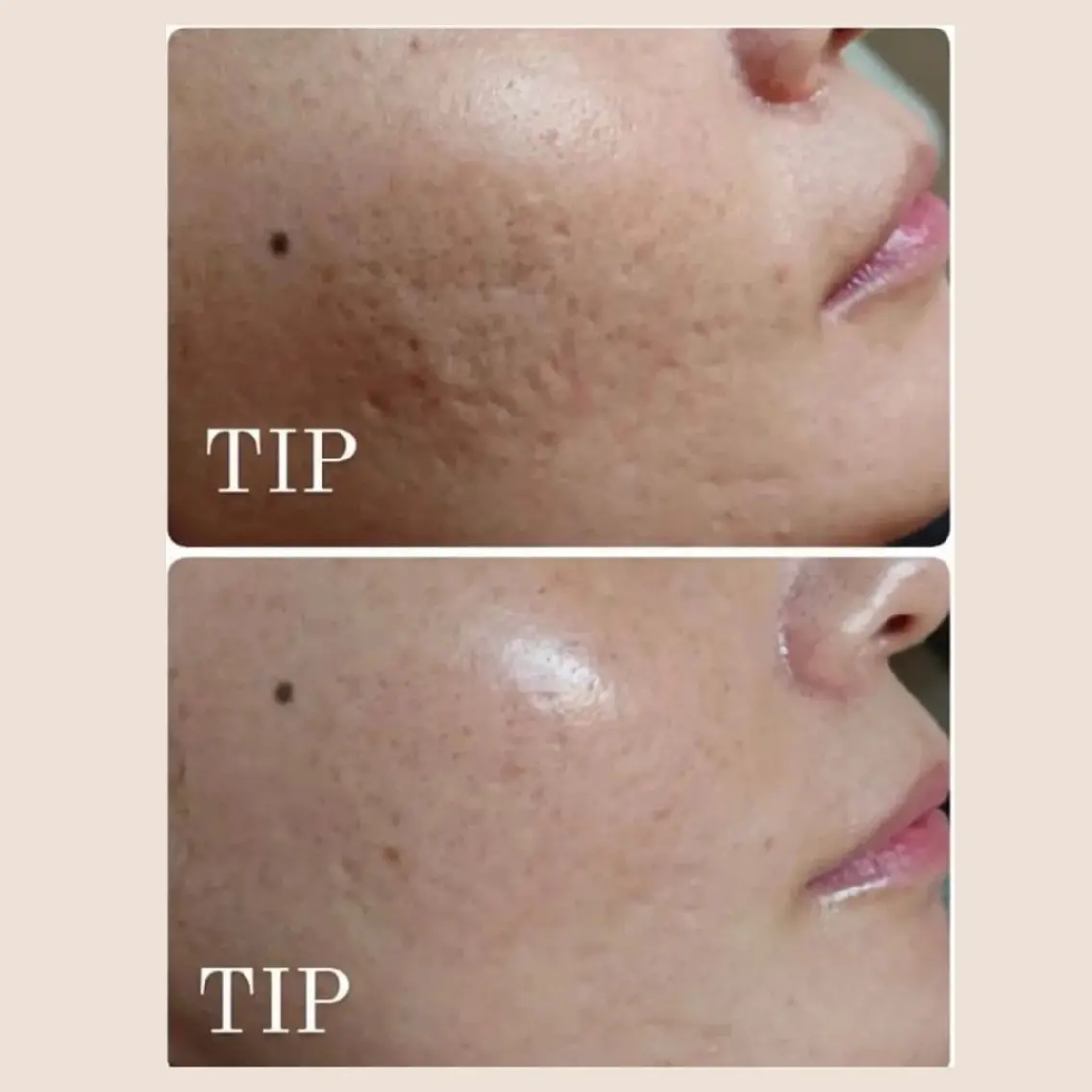 エステ Ellebeauty relaxationのエステ・リラクイメージ