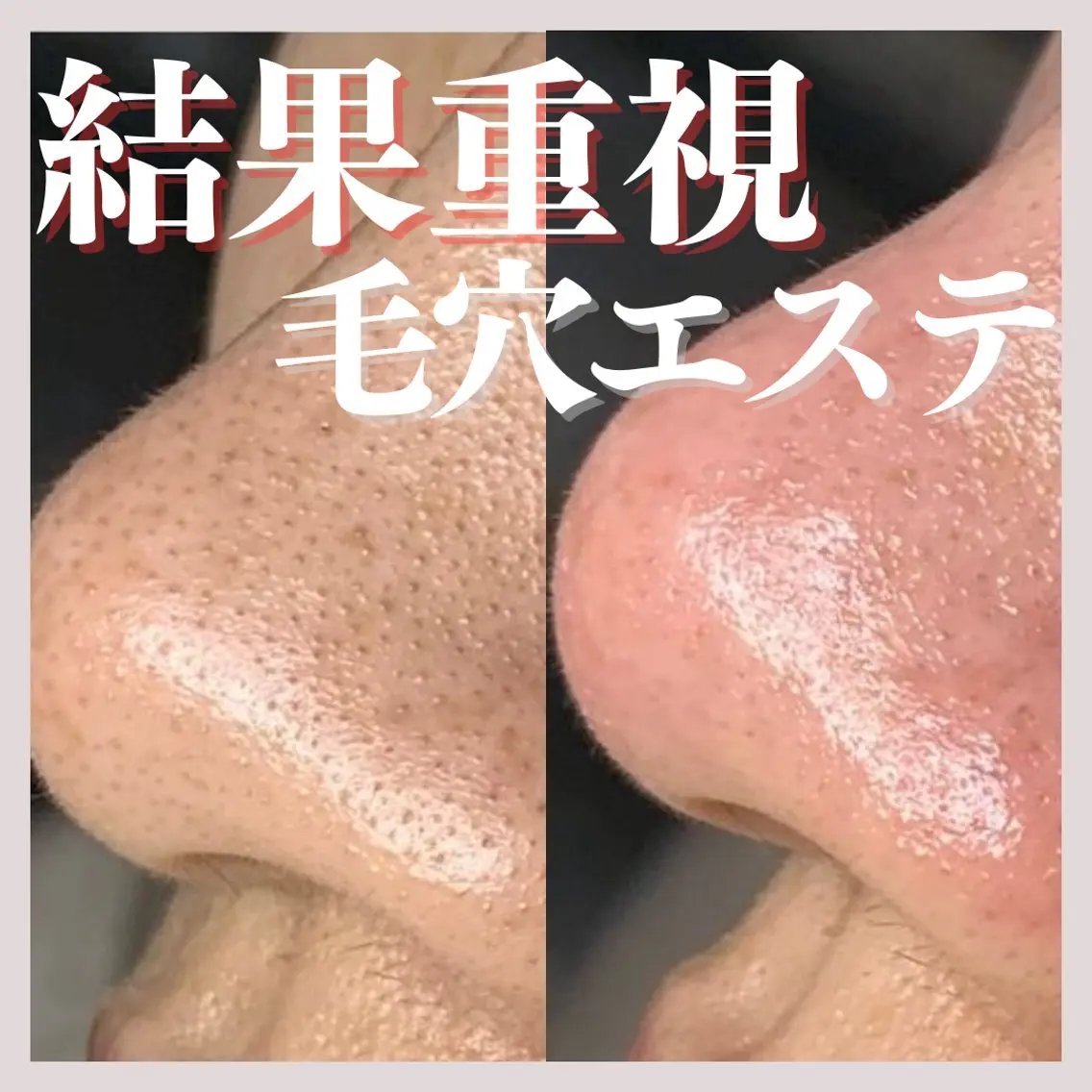 エステ salon MUSUBUのエステ・リラクイメージ