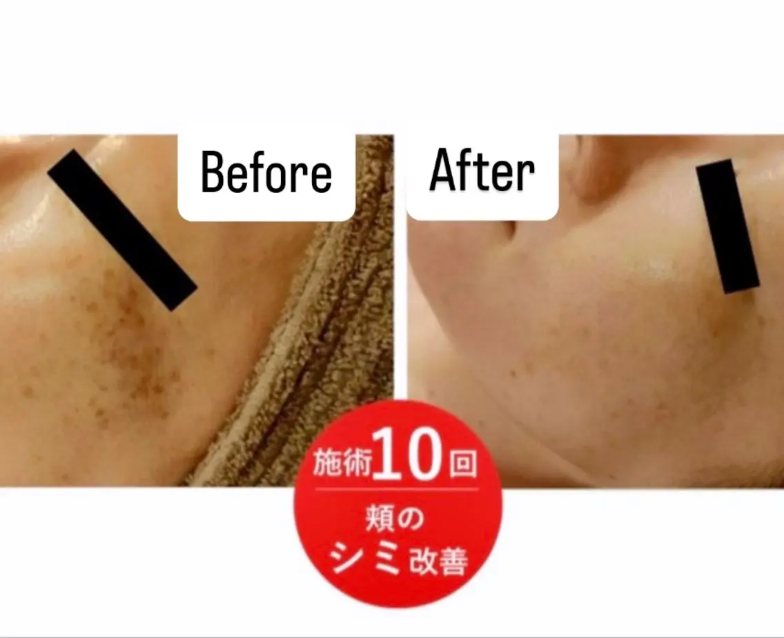エステ esthesalon O'-en-のエステ・リラクイメージ