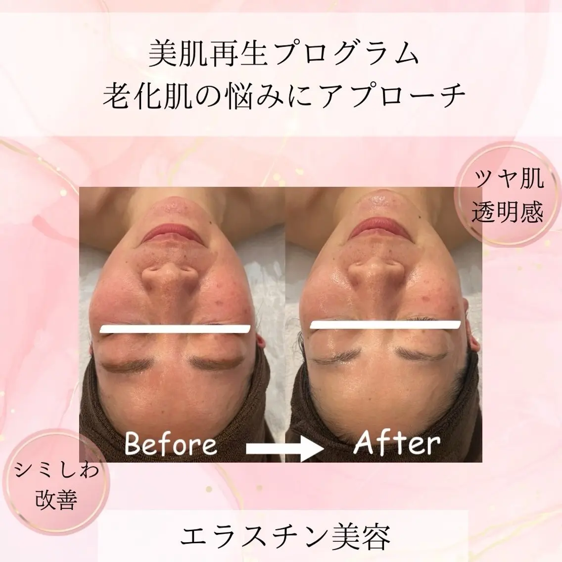 エステ beauty SalonRcoinのマツエク・マツパデザイン