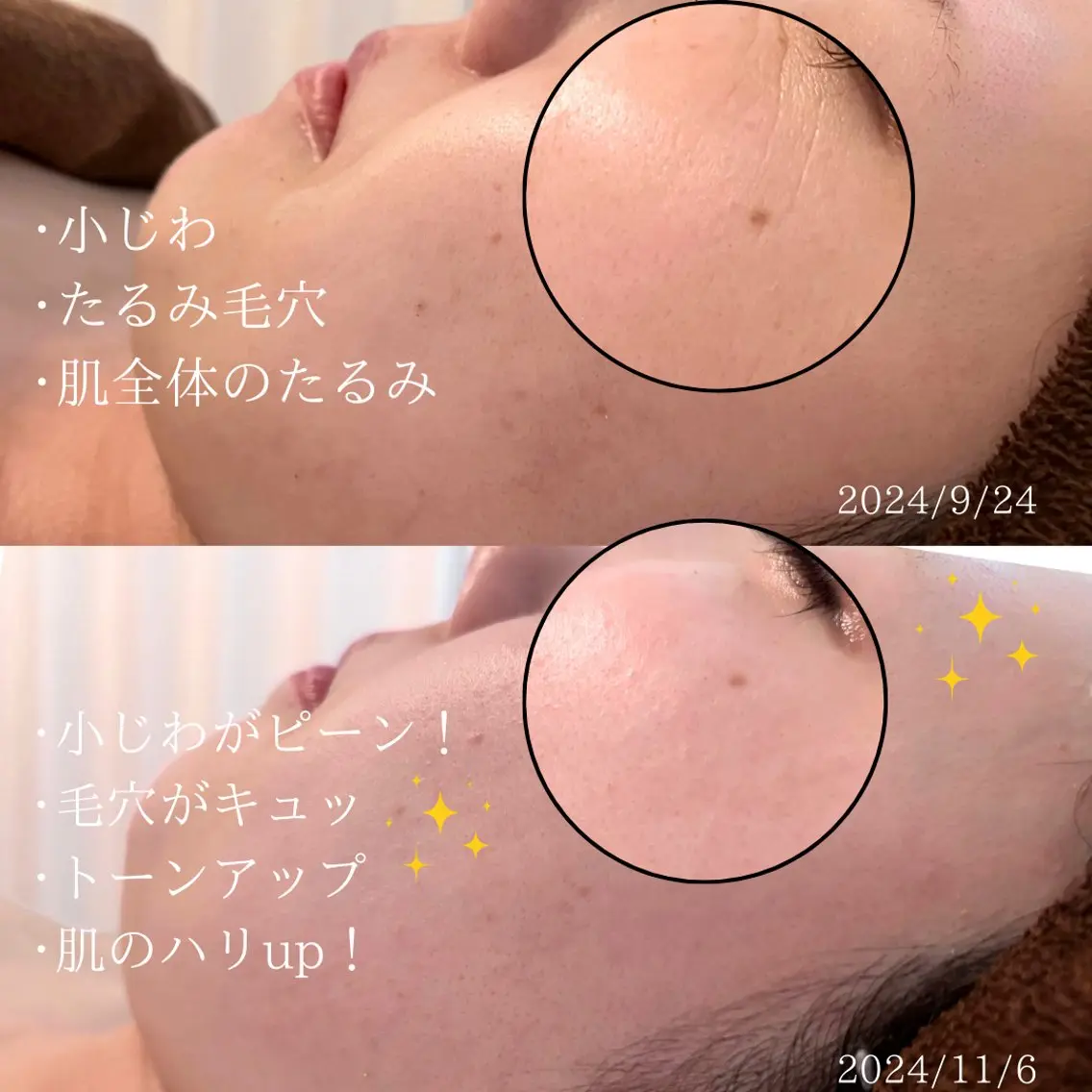 mison 安形友花のネイルデザイン