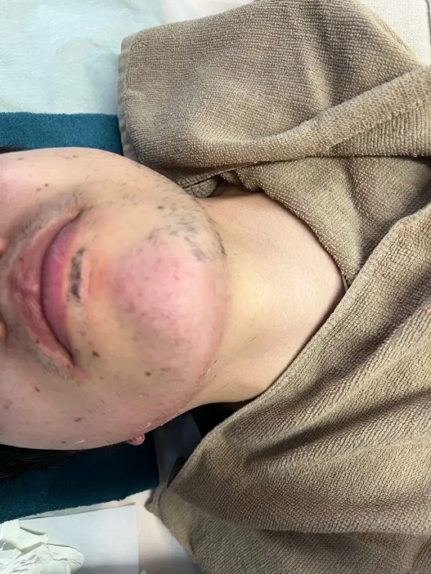 眠れるWax😴メンズヒゲ✨の写真