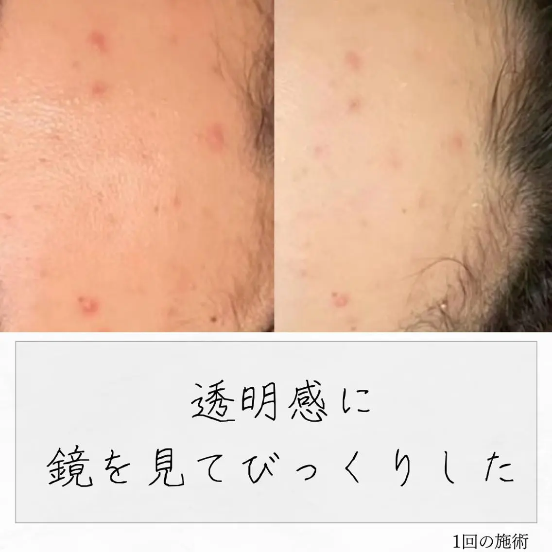 ニキビ経験者が施術 する専門サロン🌻のエステ・リラクイメージ
