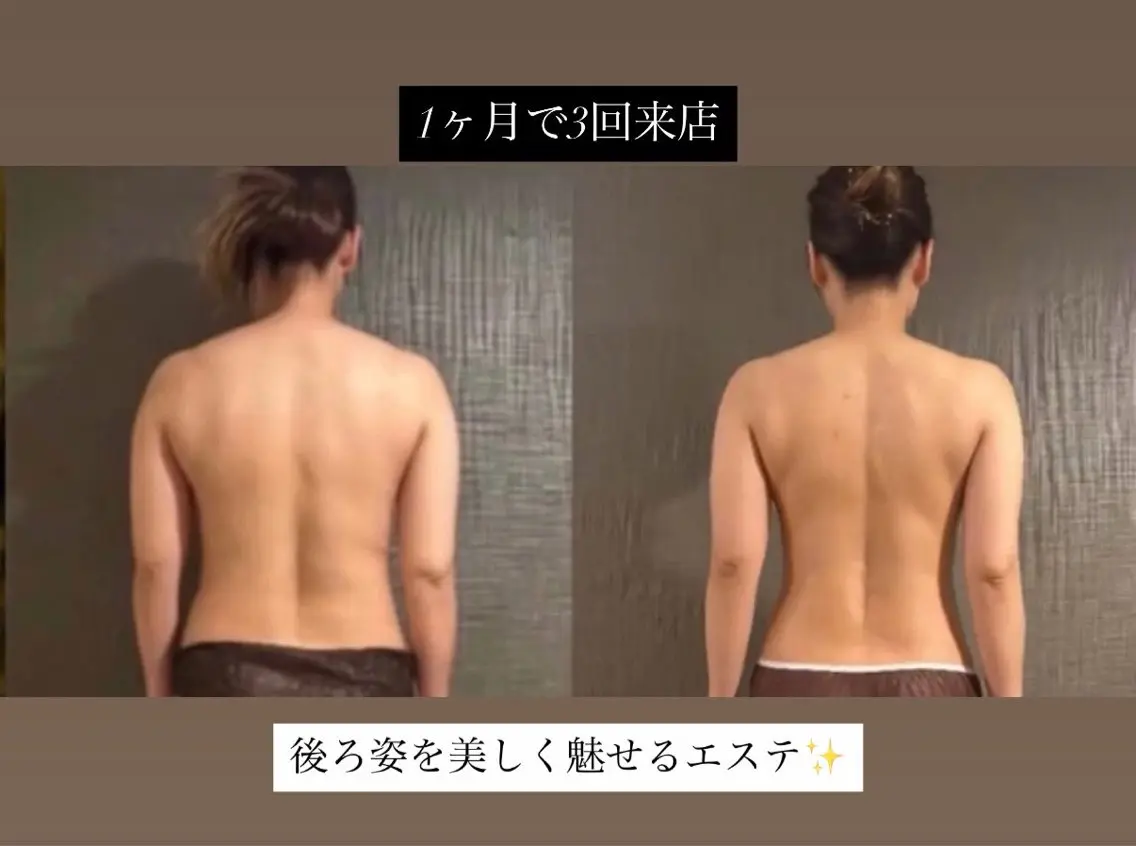Before After写真okの方📸【100分贅沢リンパケアで体質改善しながらサイズダウン】の写真