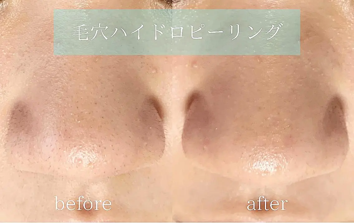 メンズ エステ 稲嶺 美華のエステ・リラクイメージ