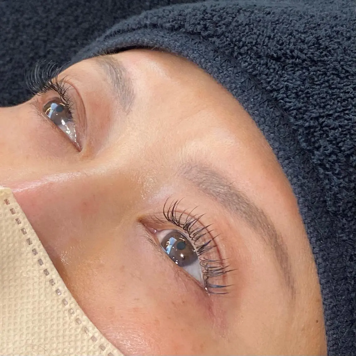 フラットラッシュ100本の写真