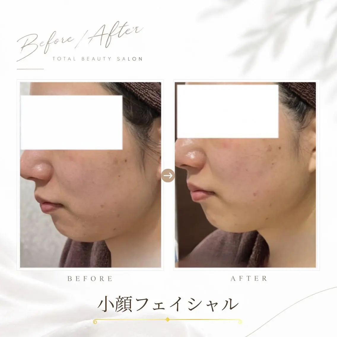 《 肌質×美肌 》 addissimoのエステ・リラクイメージ