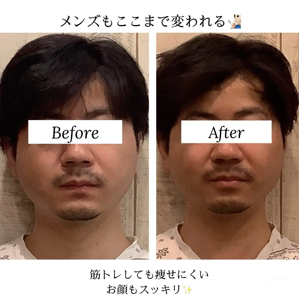 小顔矯正Speed KOGAO渋谷本店のエステ・リラクイメージ