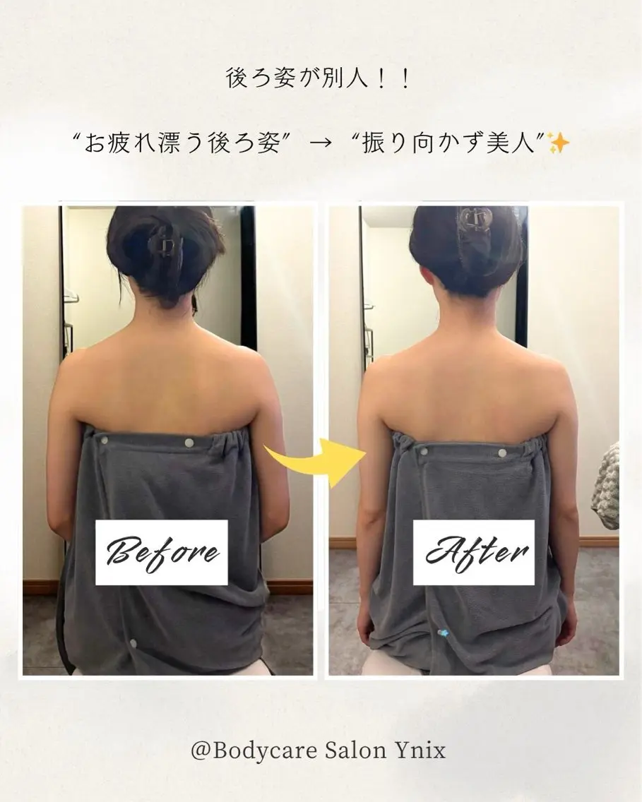 【首肩爽快】微弱電流×ボディケアの写真