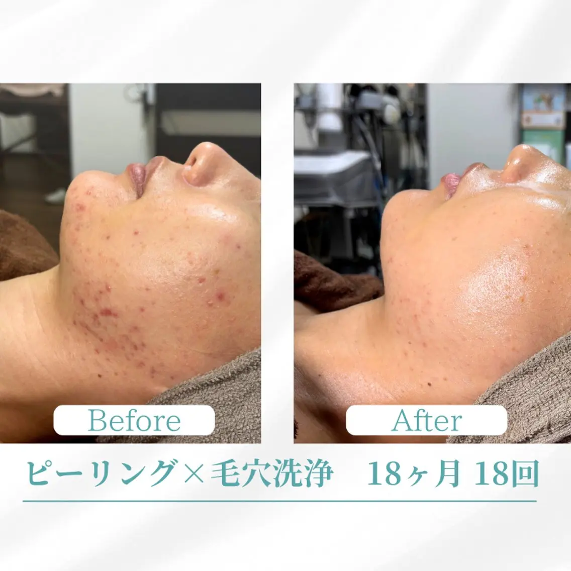 エステ 美容鍼サロン ボディコンディションのエステ・リラクイメージ