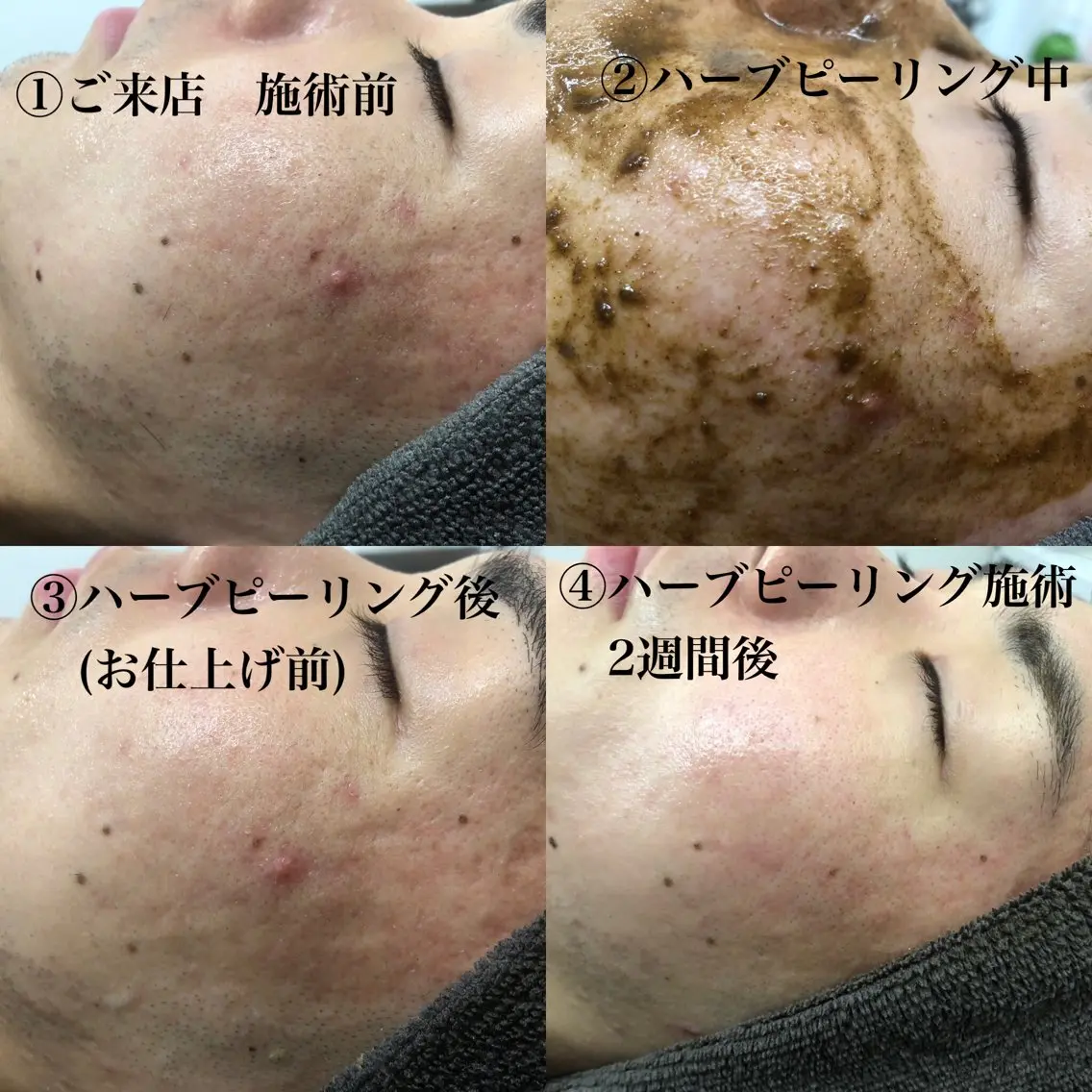 メンズ エステサロン NINEのエステ・リラクイメージ