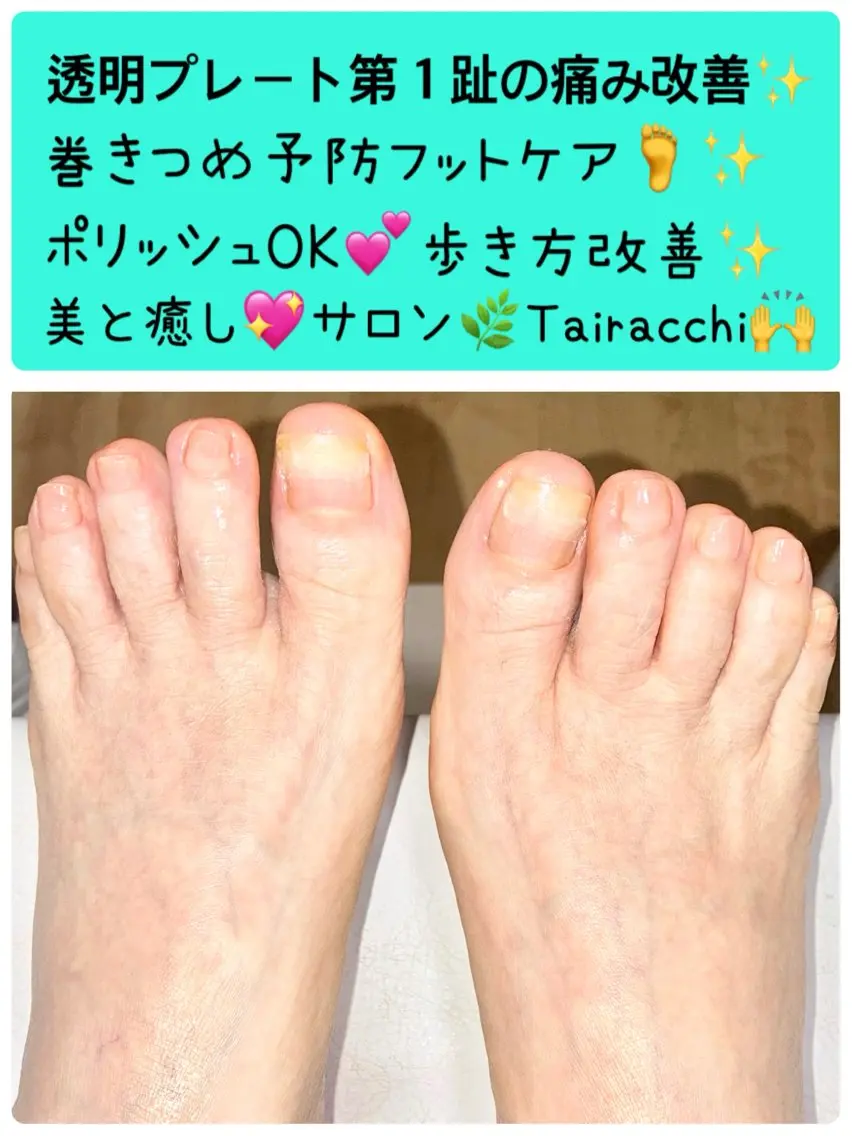 ネイル フットネイル Tairacchi タイラッチのエステ・リラクイメージ