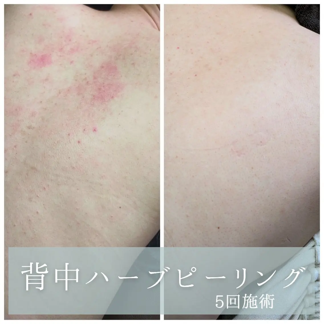 小顔痩身サロン  |  Meguのエステ・リラクイメージ