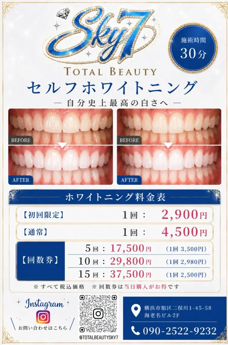 💎セルフホワイトニングで輝く白い歯へ✨の写真