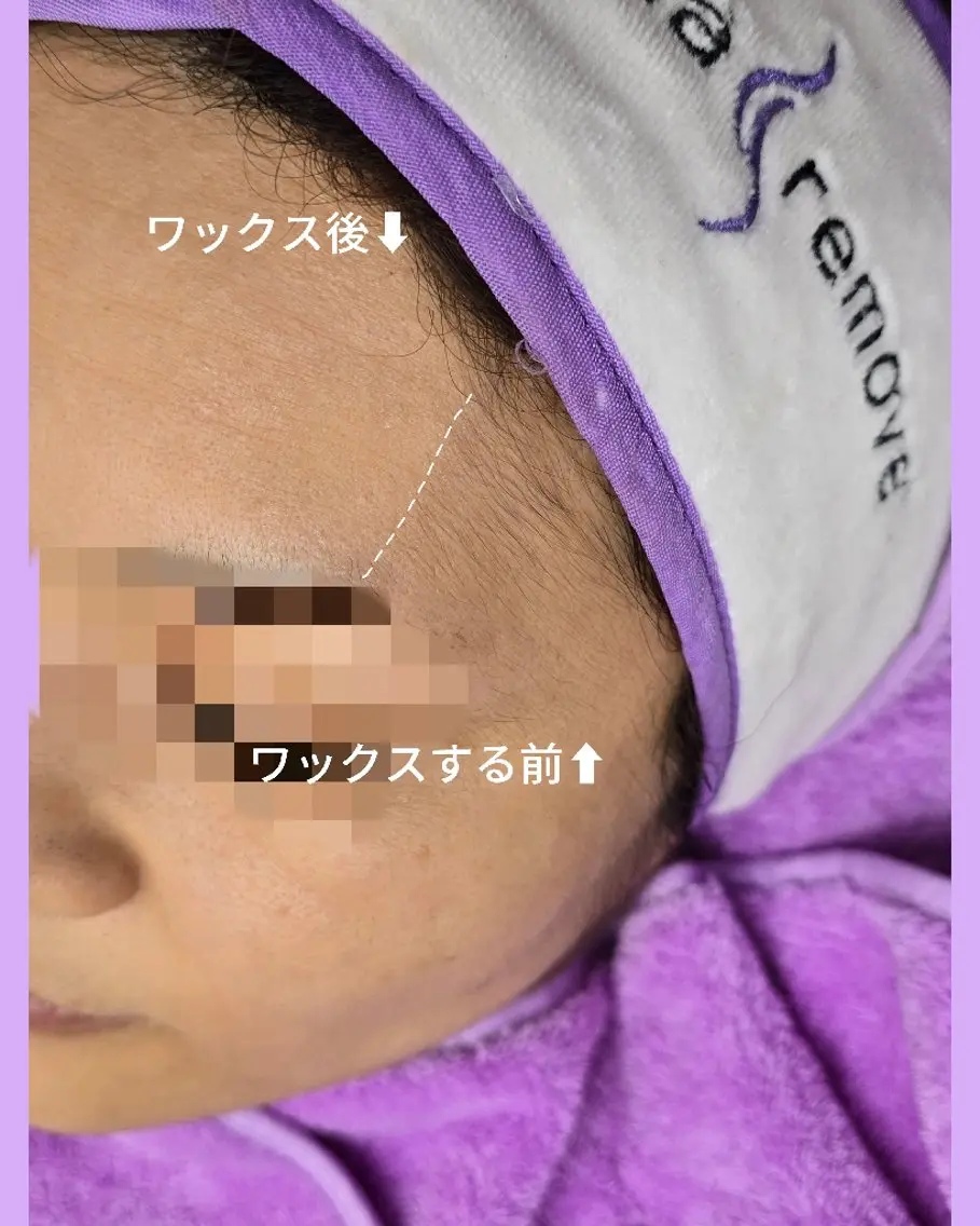 マリムーブフェイシャルワックス💜の写真