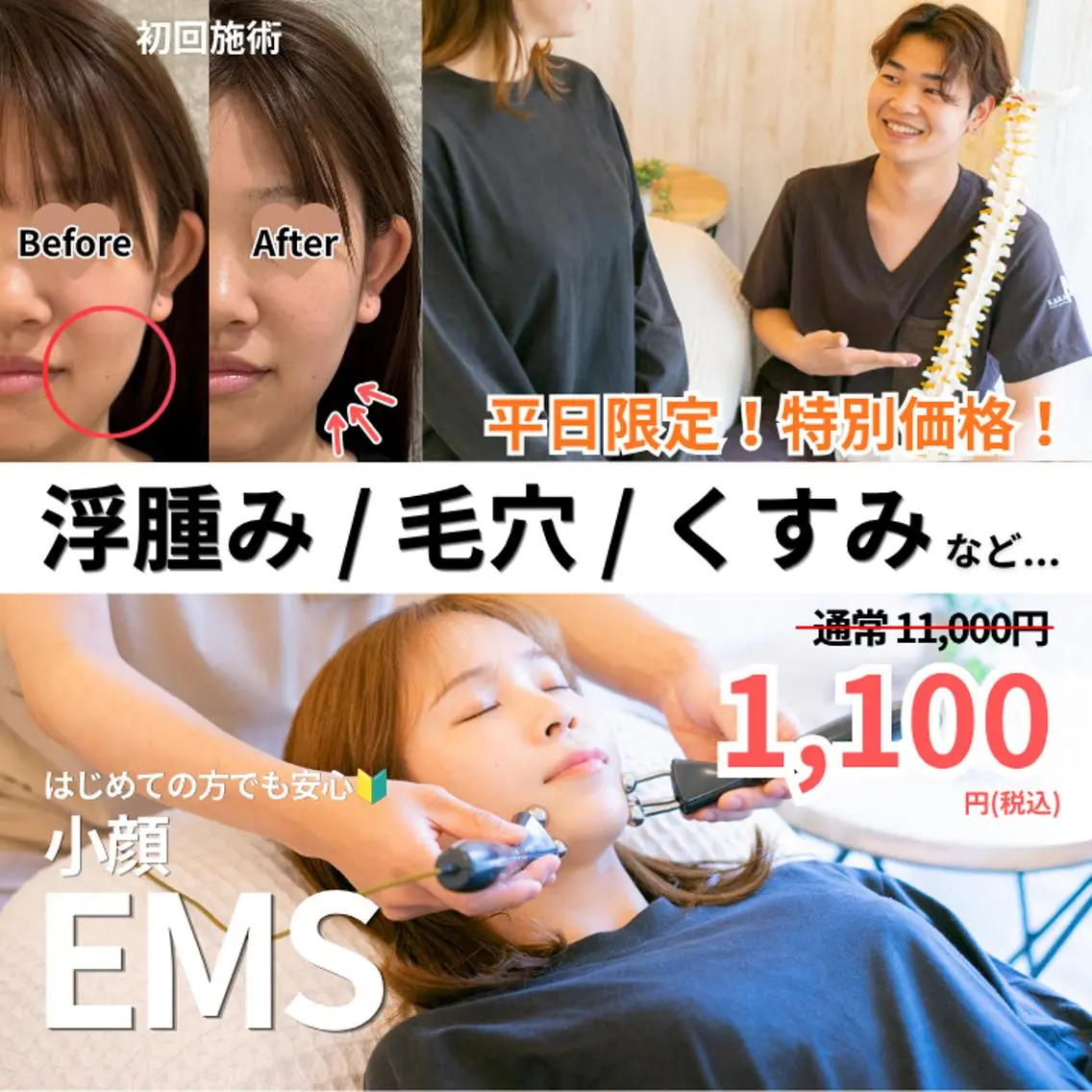初回平日限定1,100円🎉《小顔EMS/90%off❗️》むくみ/たるみ/フェイスライン/ほうれい線/表情筋/眼精疲労の写真