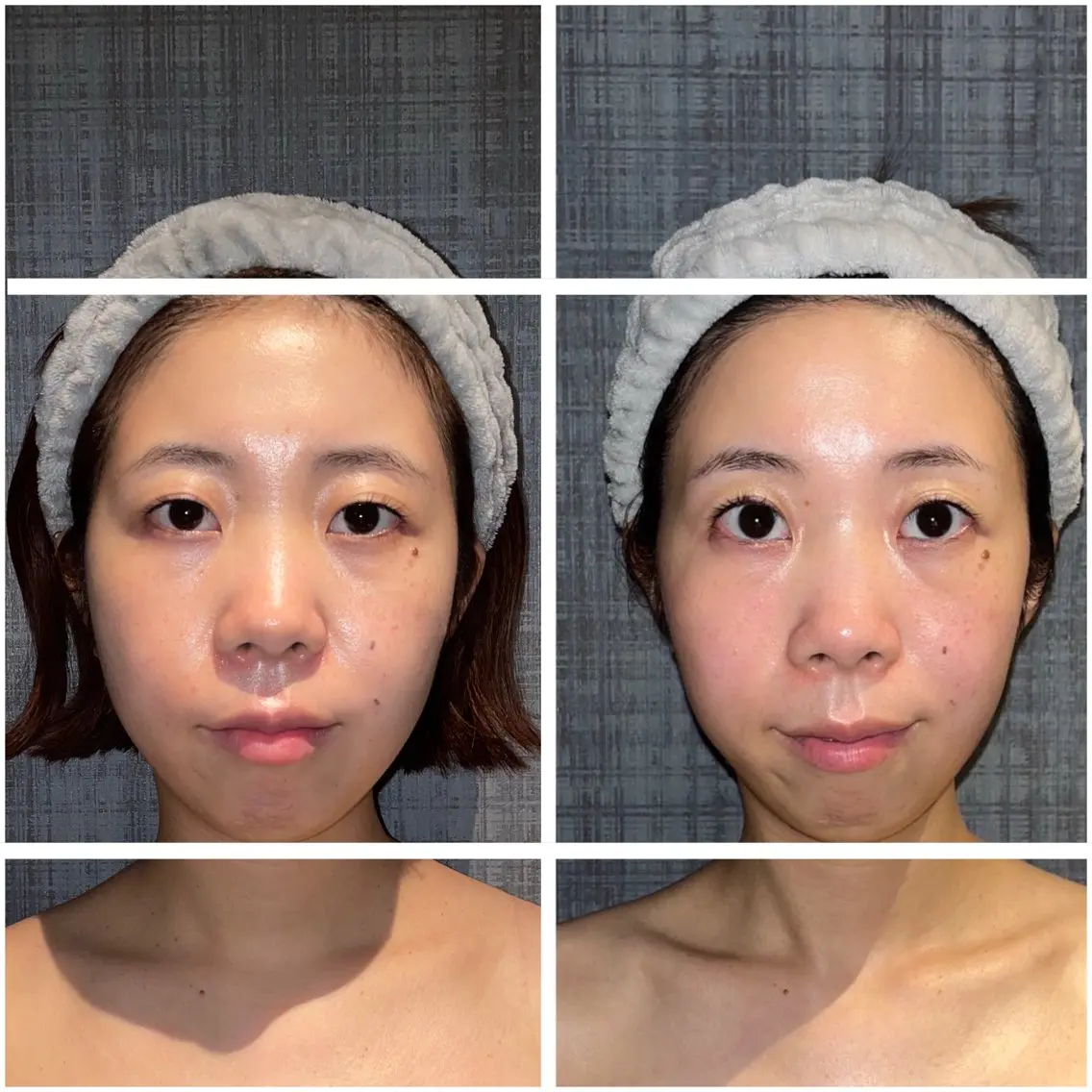 【平日×3名限定】5回で実感！結果にこだわる《こりとりコルギ》🦴💆‍♀️✨90分施術の写真