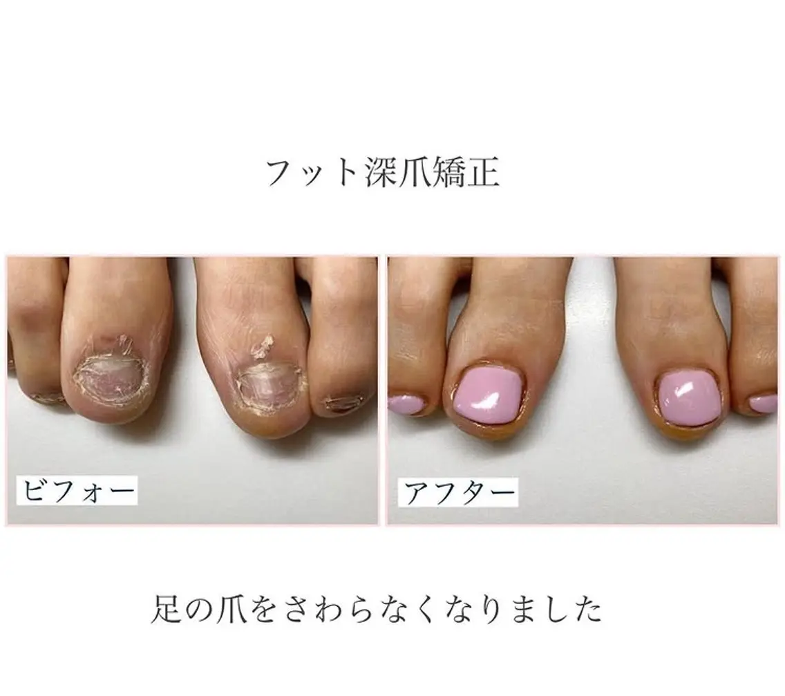 ネイル フットネイル フットネイル ネイルサロン アリュームのネイルデザイン