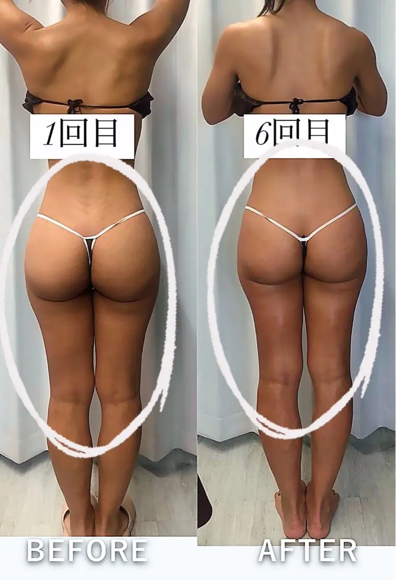 エステ 痩身・脱毛・肌管理 Rechica心斎橋のエステ・リラクイメージ