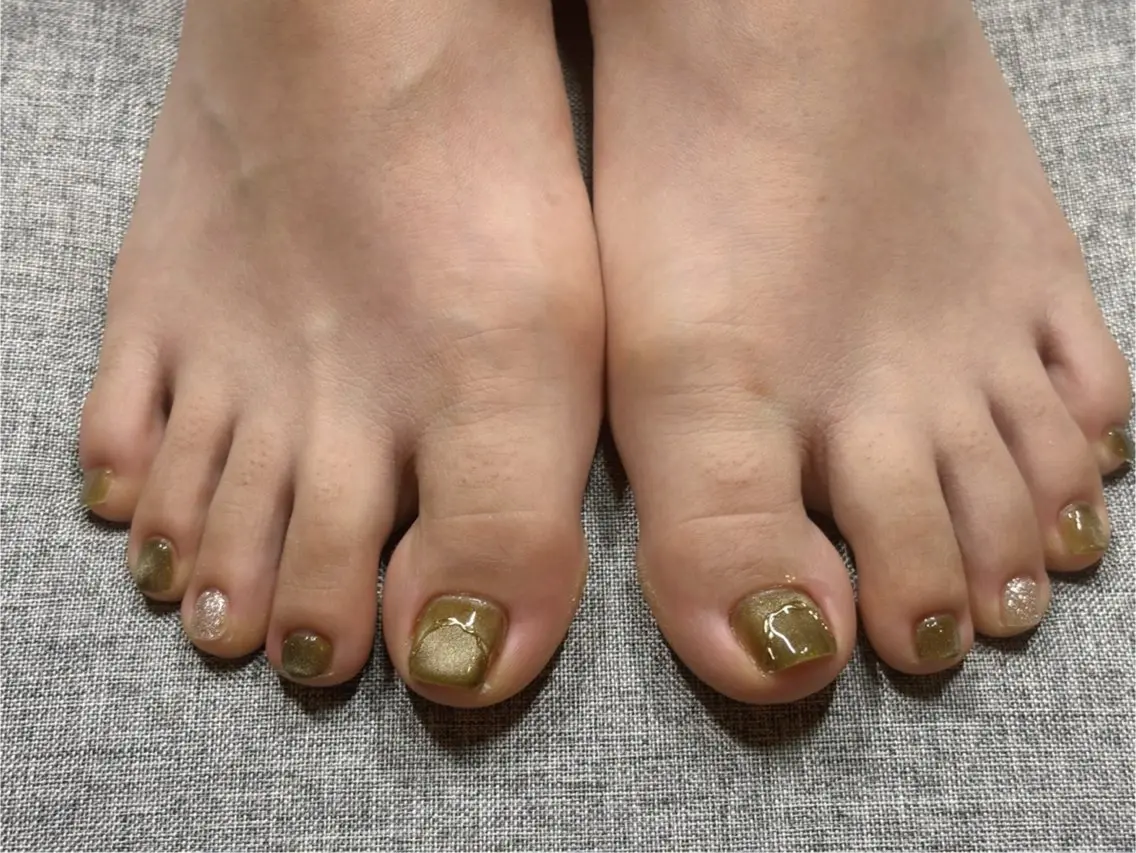 ネイル フットネイル -BERYL- KEIKOのネイルデザイン