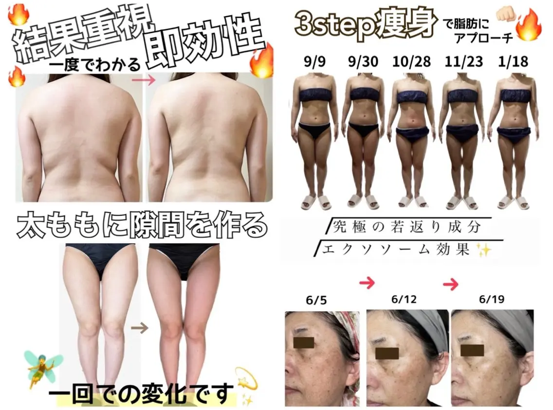 stella都度払い 痩身小顔まつげパーマのマツエク・マツパデザイン