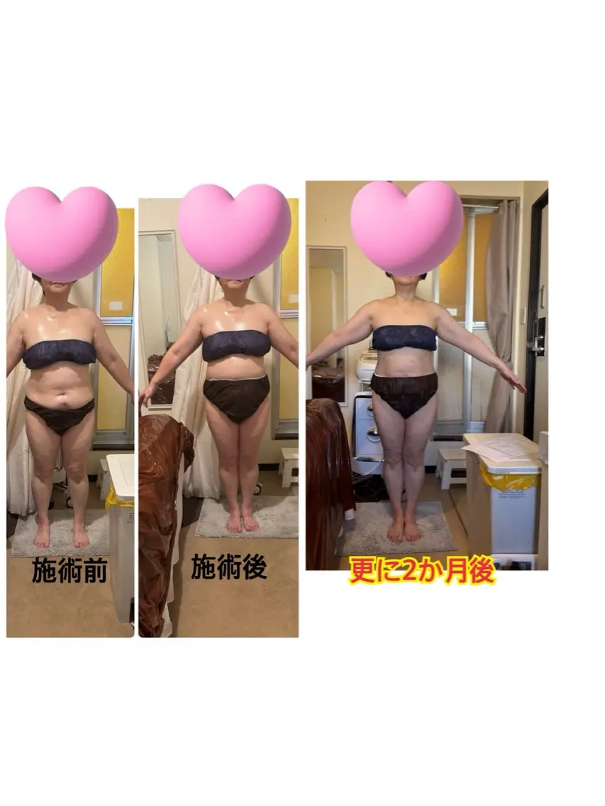 エステ 西田 美恵子のエステ・リラクイメージ