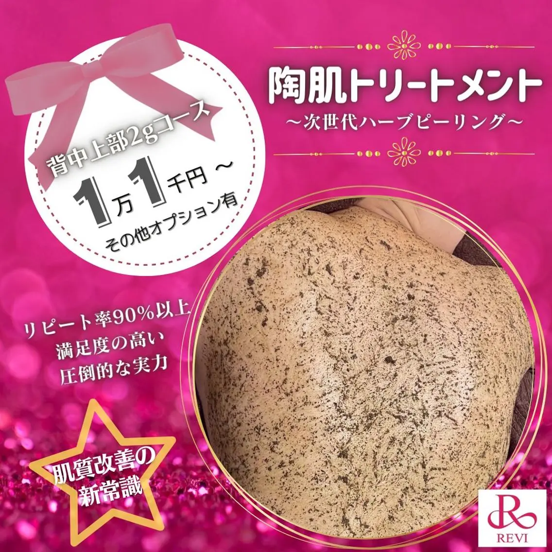 【REVI陶肌トリートメント】剥離無し　ハーブピーリング🌿陶肌トリートメント　背中2g 気になる箇所の施術の写真
