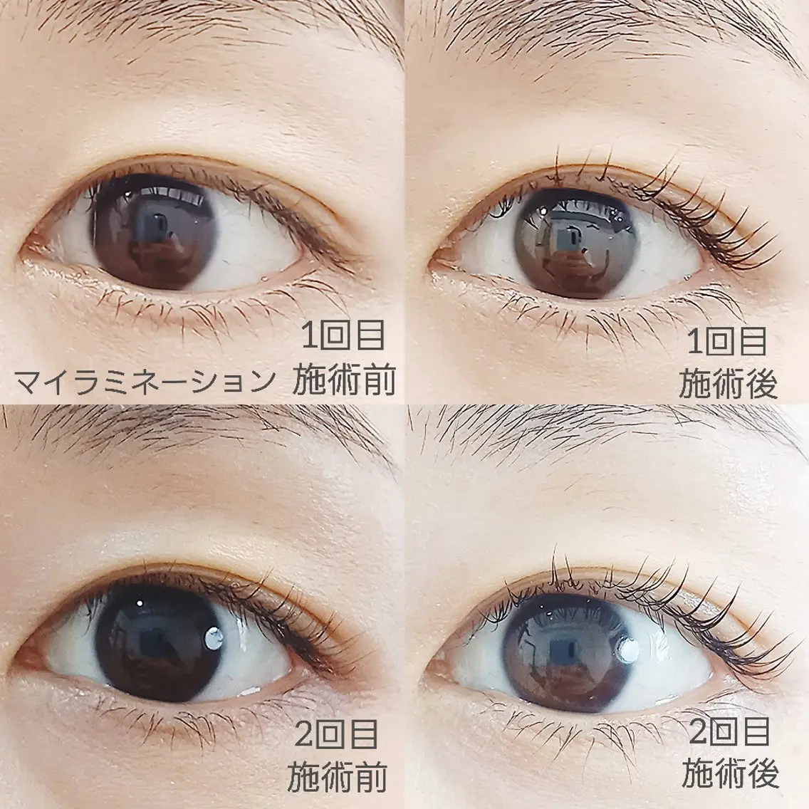 マツエク・マツパ 一重×まつ毛パーマ マツパ  MIKU .のマツエク・マツパデザイン