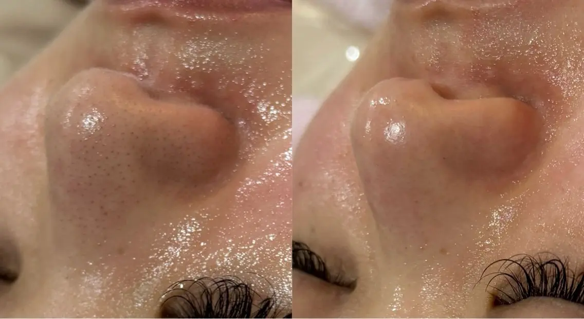 salondeBe 🩵フェイシャル専門のエステ・リラクイメージ