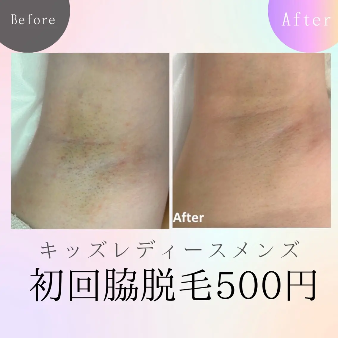 メンズ キッズ 脱毛 エステサロン さらのエステ・リラクイメージ