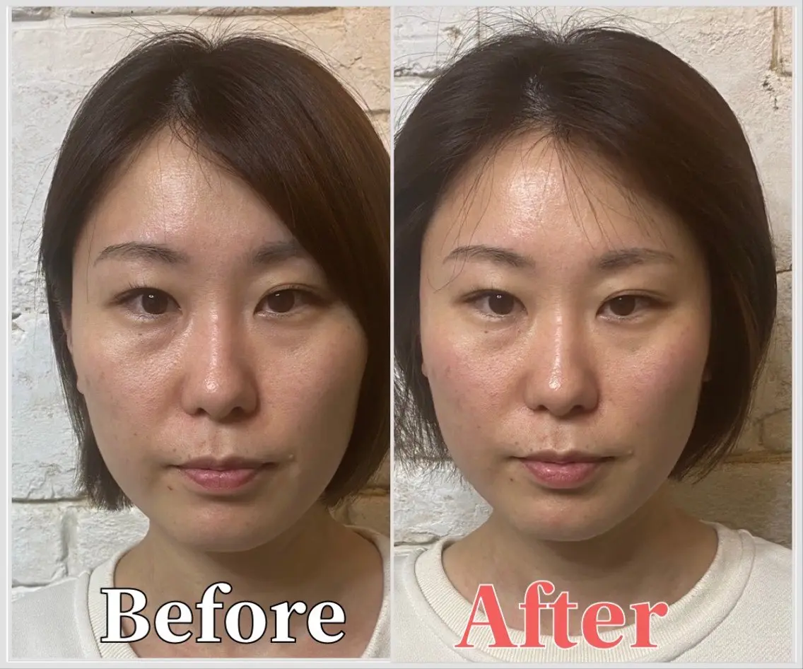 整体 LALUZ中目黒のその他イメージ