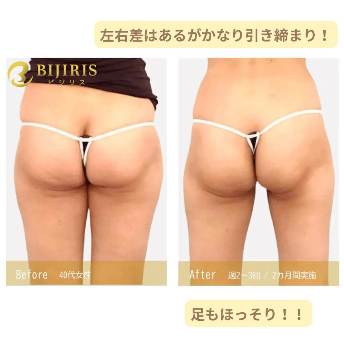 セルフ脱毛/美尻イス キングスサロン熊本のエステ・リラクイメージ