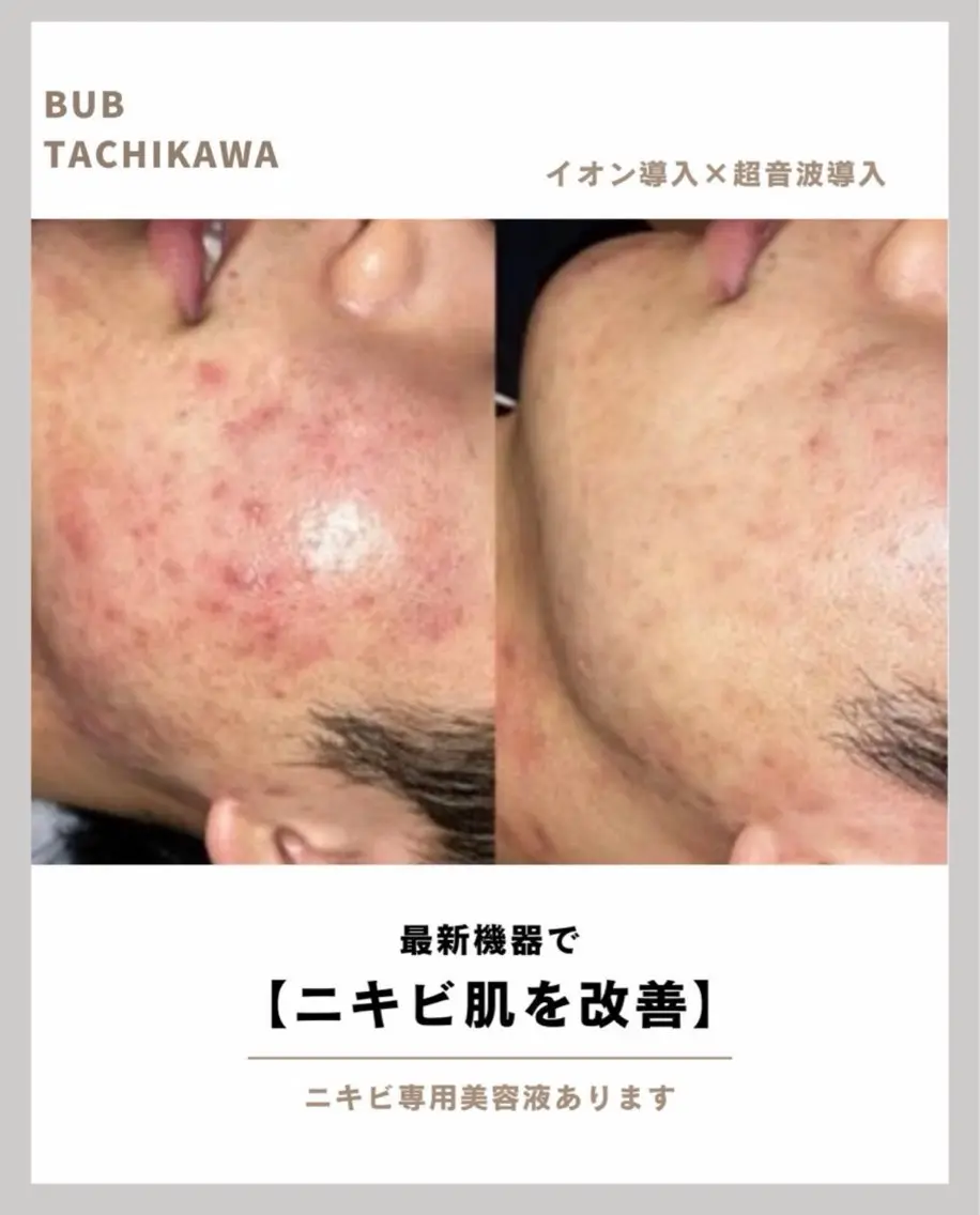 メンズ エステ 【BUB立川】 ゆかのエステ・リラクイメージ